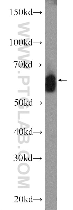 Western Blot (WB) analysis of BGC-823 cells using ATG13 Polyclonal antibody (18258-1-AP)