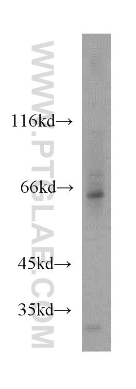 Western Blot (WB) analysis of mouse thymus tissue using ATG13 Polyclonal antibody (18258-1-AP)