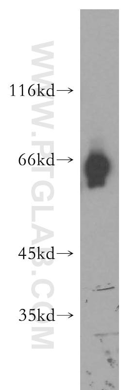 Western Blot (WB) analysis of human brain tissue using ATG13 Polyclonal antibody (18258-1-AP)