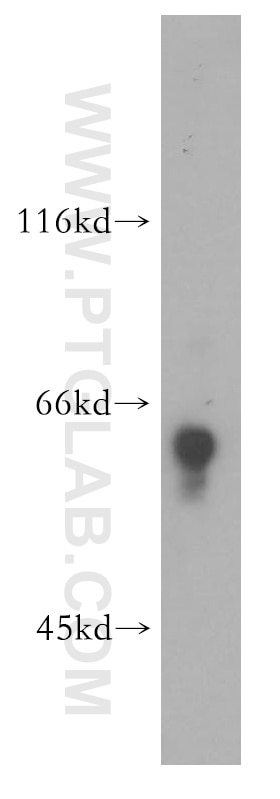 WB analysis of mouse cerebellum using 18258-1-AP