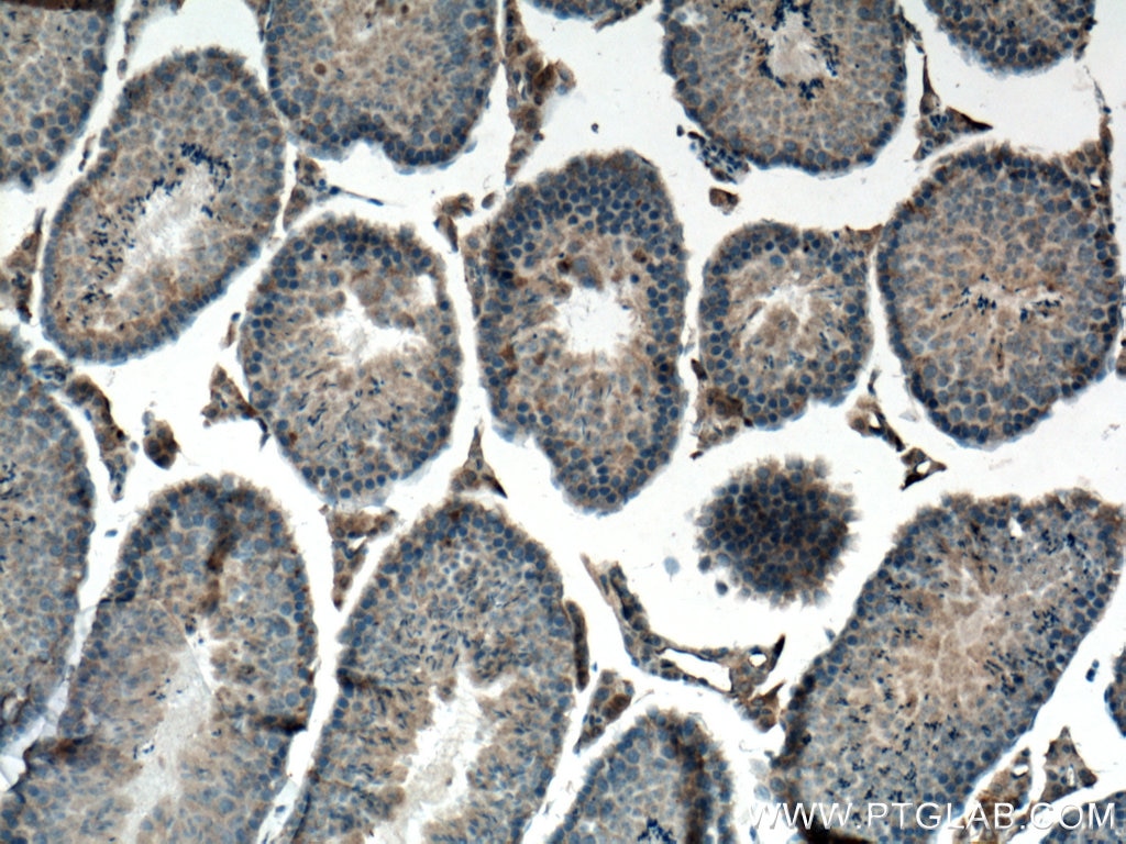 Immunohistochemistry (IHC) staining of mouse testis tissue using ATG13 Monoclonal antibody (66708-1-Ig)