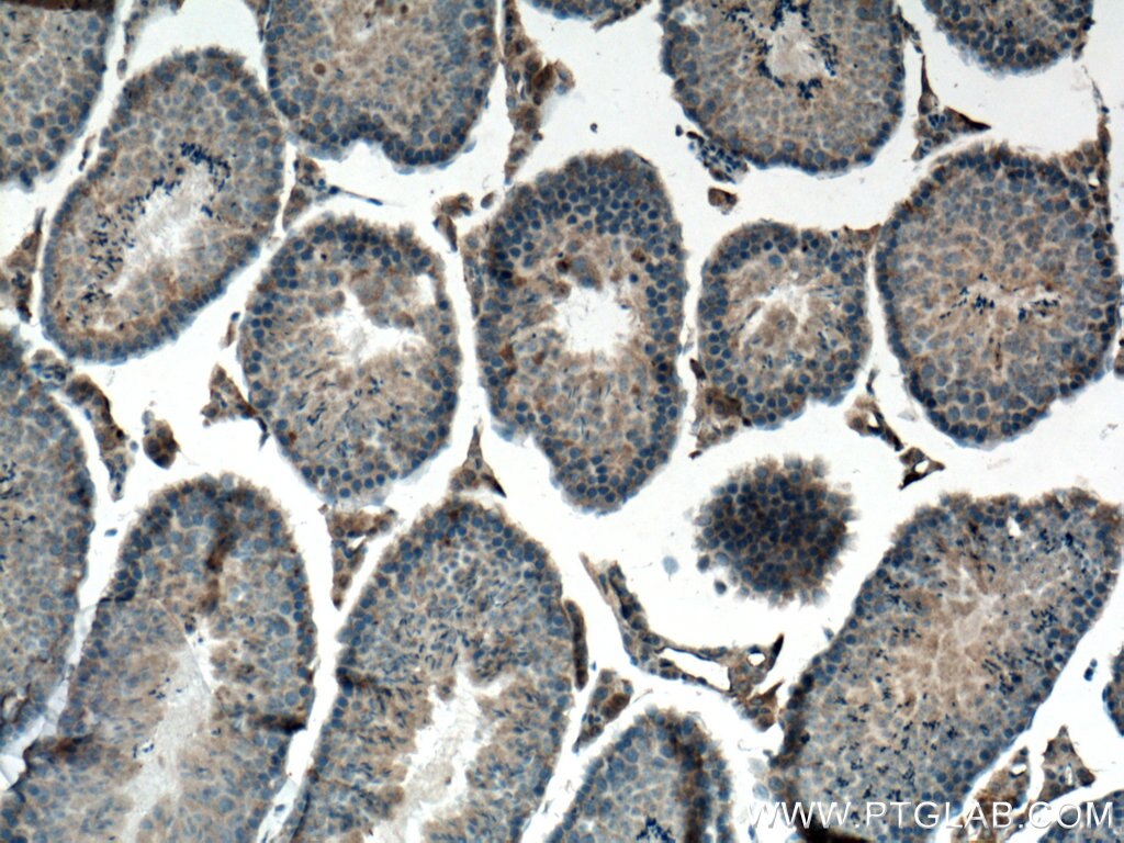 IHC staining of mouse testis using 66708-1-Ig