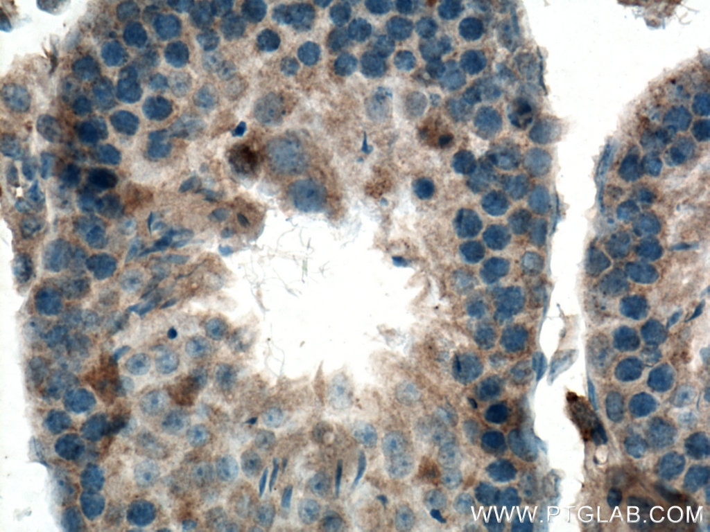 IHC staining of mouse testis using 66708-1-Ig