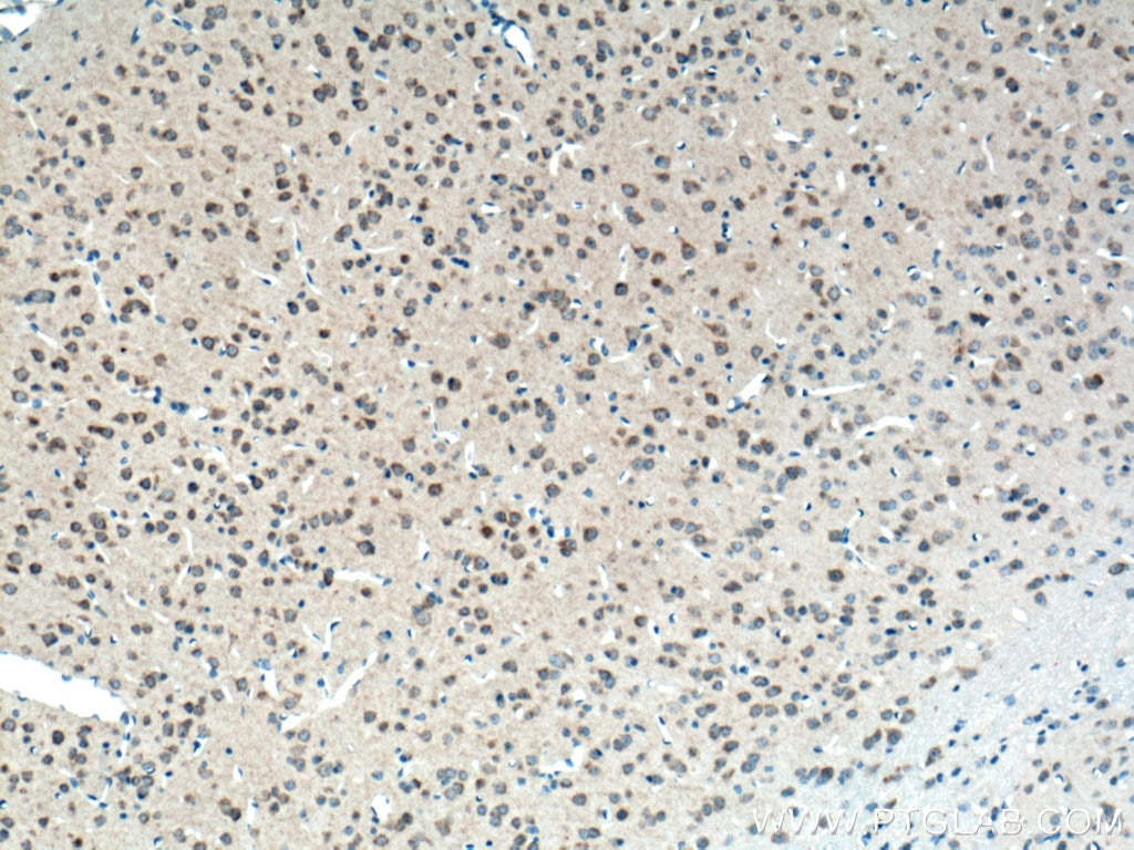 IHC staining of mouse brain using 66708-1-Ig