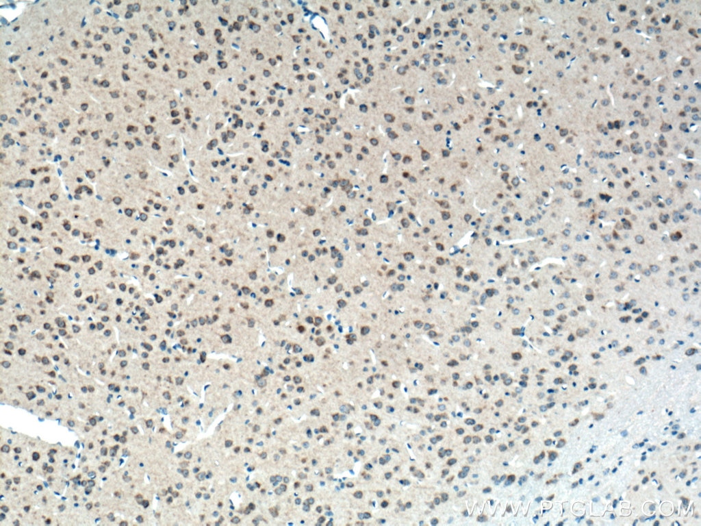 Immunohistochemistry (IHC) staining of mouse brain tissue using ATG13 Monoclonal antibody (66708-1-Ig)