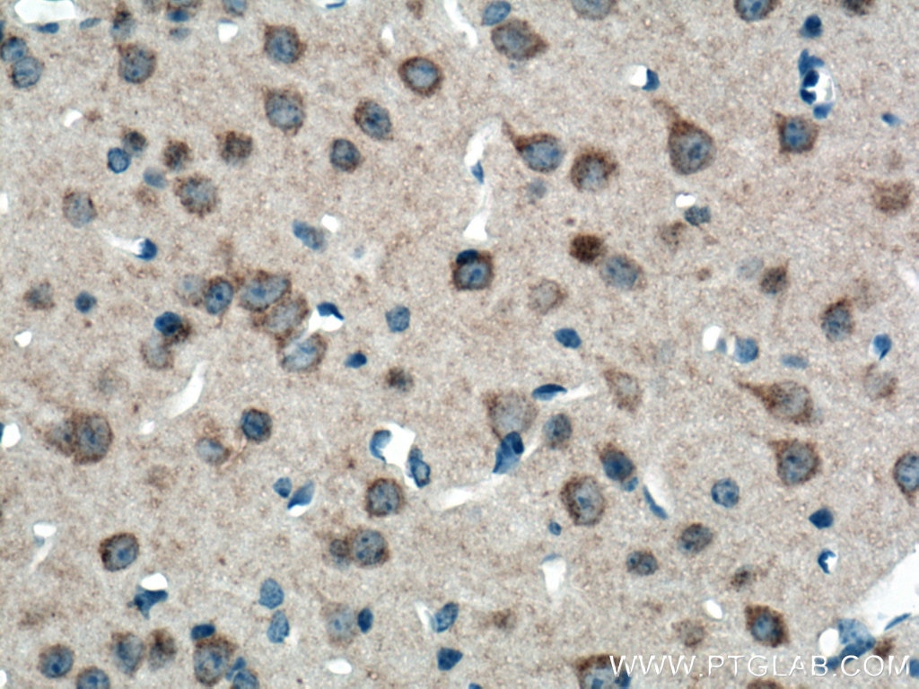 Immunohistochemistry (IHC) staining of mouse brain tissue using ATG13 Monoclonal antibody (66708-1-Ig)