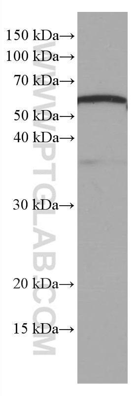 Western Blot (WB) analysis of pig brain tissue using ATG13 Monoclonal antibody (66708-1-Ig)