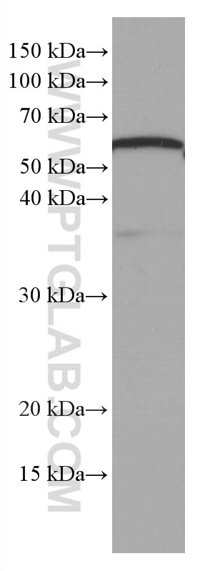 WB analysis of pig brain using 66708-1-Ig