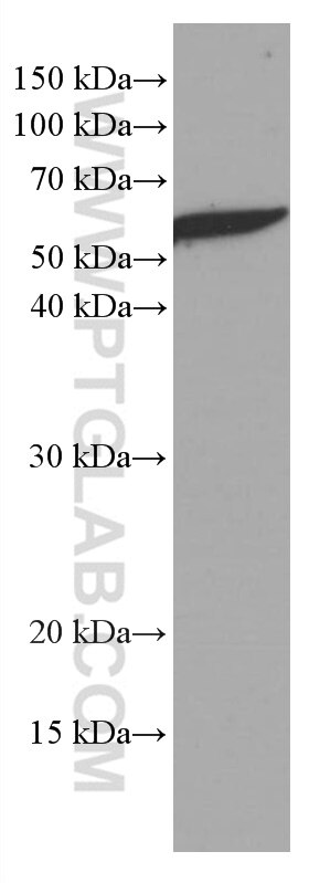 Western Blot (WB) analysis of mouse brain tissue using ATG13 Monoclonal antibody (66708-1-Ig)