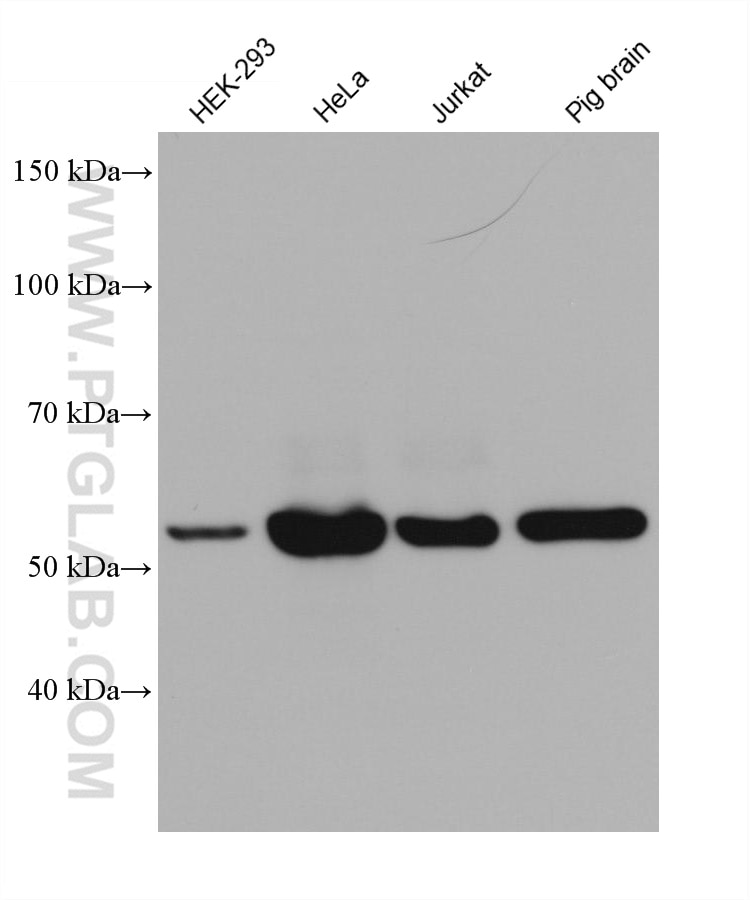 Western Blot (WB) analysis of various lysates using ATG13 Monoclonal antibody (66708-1-Ig)