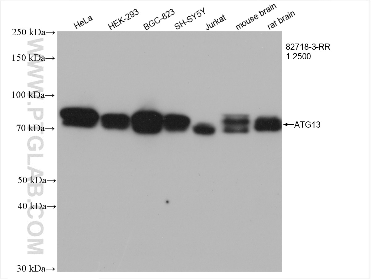 Western Blot (WB) analysis of various lysates using KIAA0652 Recombinant antibody (82718-3-RR)