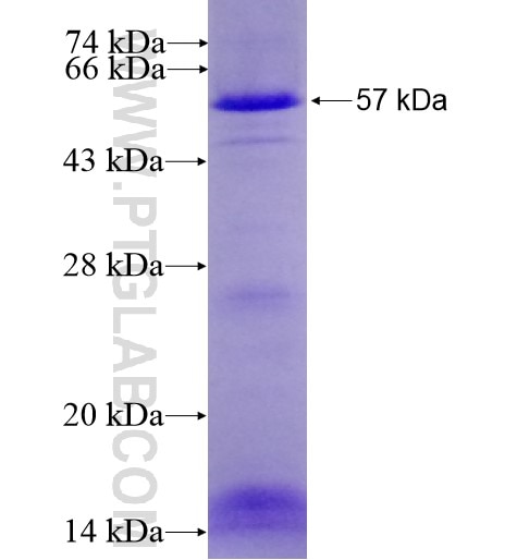 KIAA0652 fusion protein Ag12968 SDS-PAGE