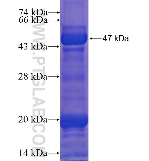 KIAA0748 fusion protein Ag23218 SDS-PAGE