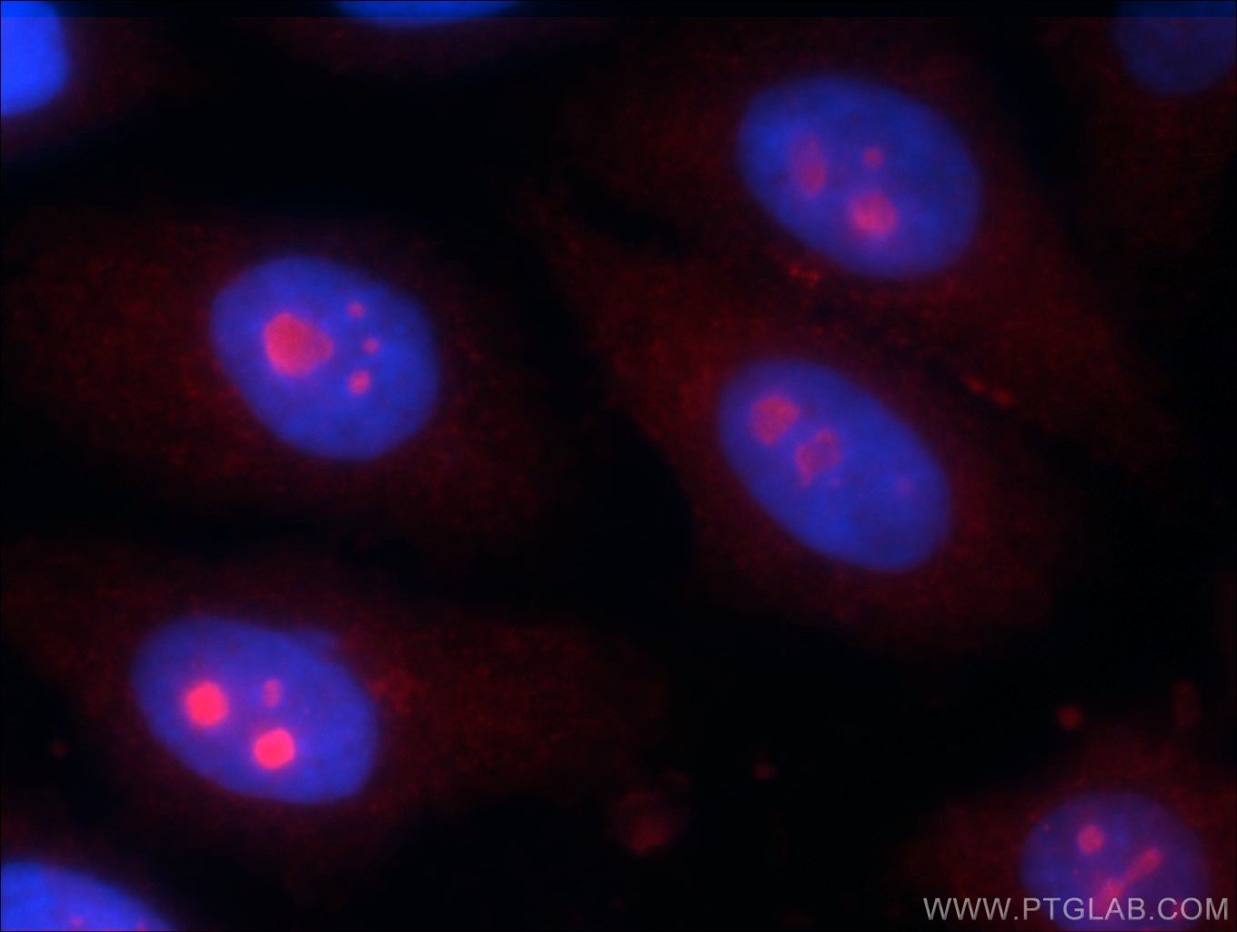 Immunofluorescence (IF) / fluorescent staining of HepG2 cells using KIAA0774 Polyclonal antibody (24921-1-AP)