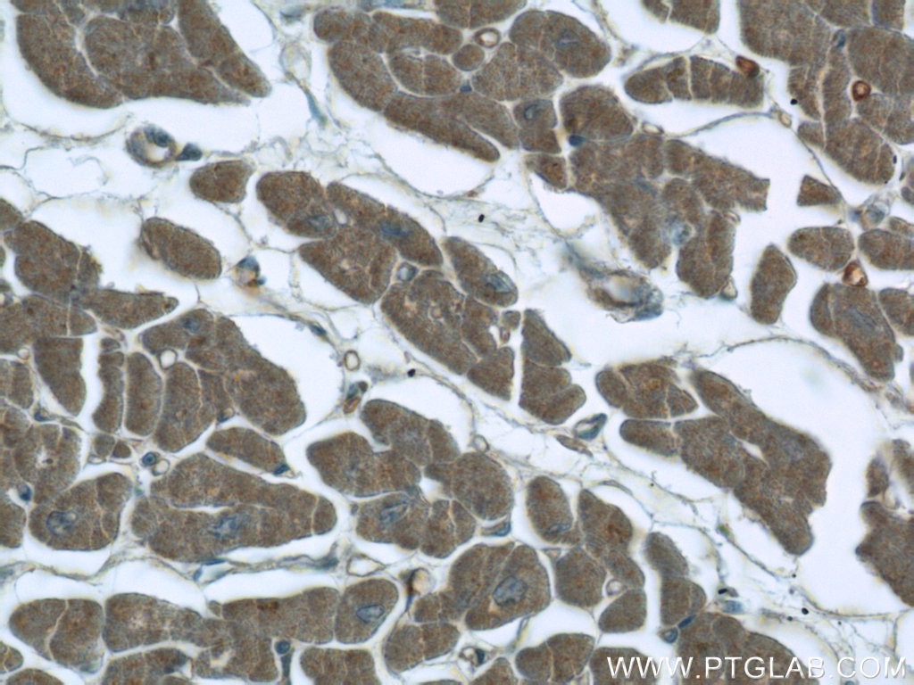 Immunohistochemistry (IHC) staining of human heart tissue using KIAA0774 Polyclonal antibody (24921-1-AP)