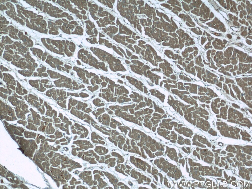 Immunohistochemistry (IHC) staining of human heart tissue using KIAA0774 Polyclonal antibody (24921-1-AP)