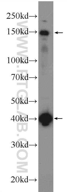 Western Blot (WB) analysis of mouse brain tissue using KIAA0774 Polyclonal antibody (24921-1-AP)