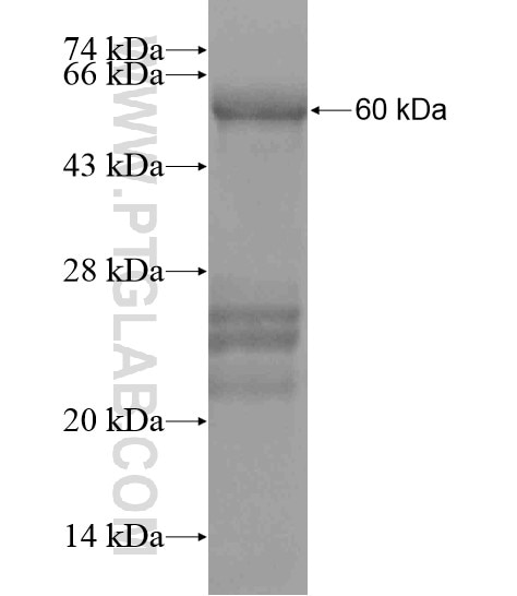 KIAA0774 fusion protein Ag20593 SDS-PAGE
