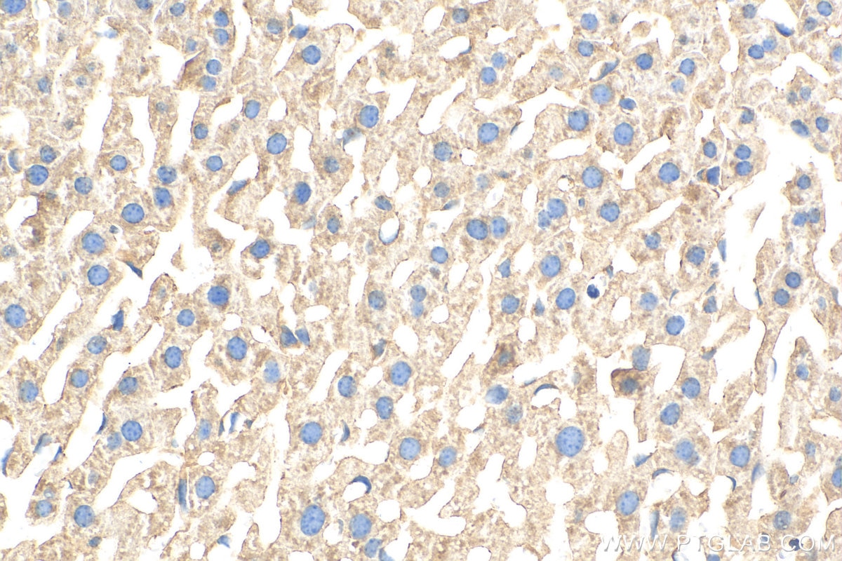 Immunohistochemistry (IHC) staining of mouse liver tissue using UFL1 Polyclonal antibody (26087-1-AP)