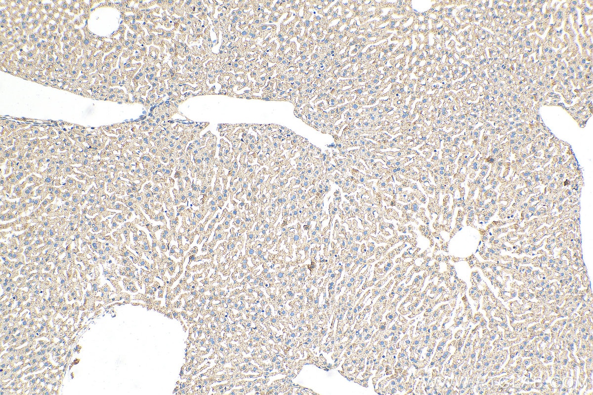 Immunohistochemistry (IHC) staining of mouse liver tissue using UFL1 Polyclonal antibody (26087-1-AP)