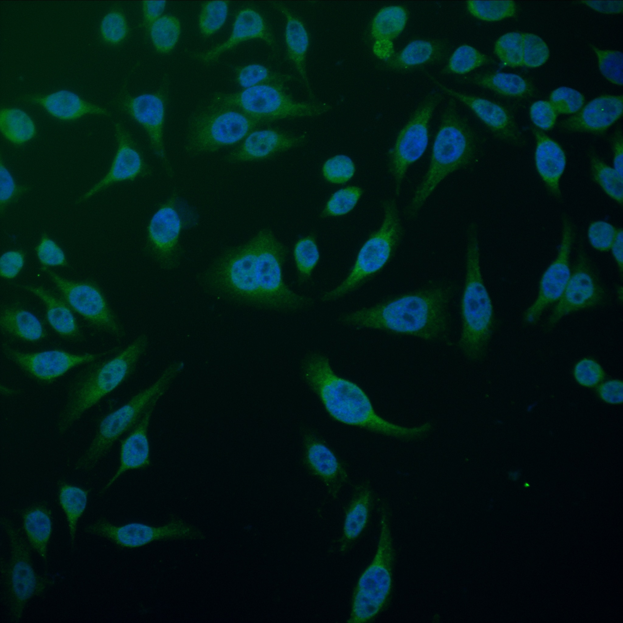 Immunofluorescence (IF) / fluorescent staining of HepG2 cells using KIAA0776 Recombinant antibody (83047-5-RR)