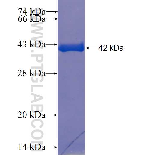 KIAA0776 fusion protein Ag23404 SDS-PAGE