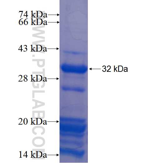 KIAA0802 fusion protein Ag22718 SDS-PAGE