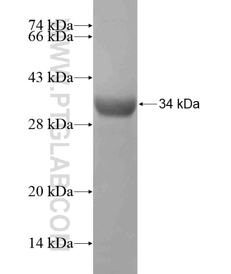 Barkor fusion protein Ag19707 SDS-PAGE