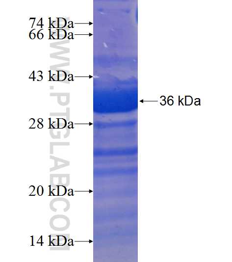 KIAA0841 fusion protein Ag22809 SDS-PAGE