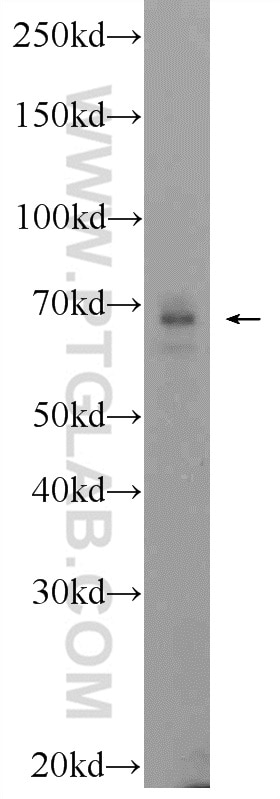 Western Blot (WB) analysis of PC-3 cells using SCC4 Polyclonal antibody (24770-1-AP)