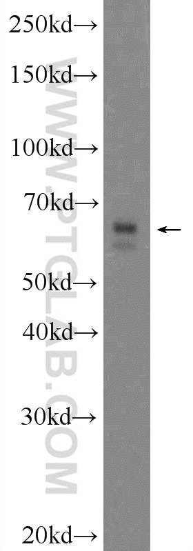Western Blot (WB) analysis of HeLa cells using SCC4 Polyclonal antibody (24770-1-AP)