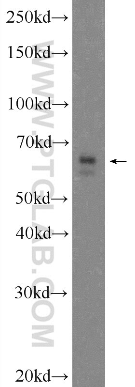 WB analysis of HeLa using 24770-1-AP