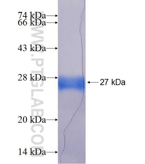 KIAA0892 fusion protein Ag19943 SDS-PAGE