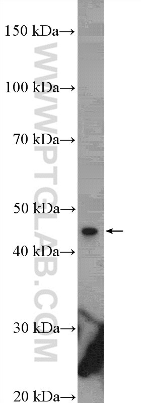 Western Blot (WB) analysis of HEK-293 cells using KIAA0895 Polyclonal antibody (21930-1-AP)