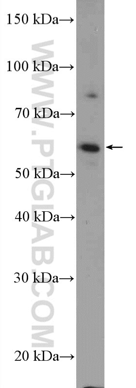Western Blot (WB) analysis of mouse testis tissue using KIAA0895 Polyclonal antibody (21930-1-AP)