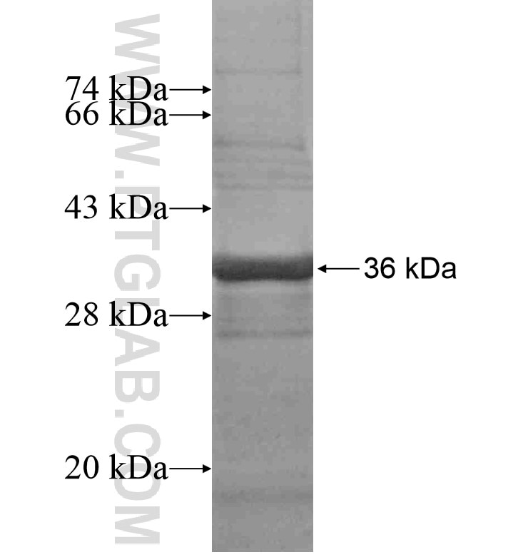KIAA0895 fusion protein Ag16533 SDS-PAGE