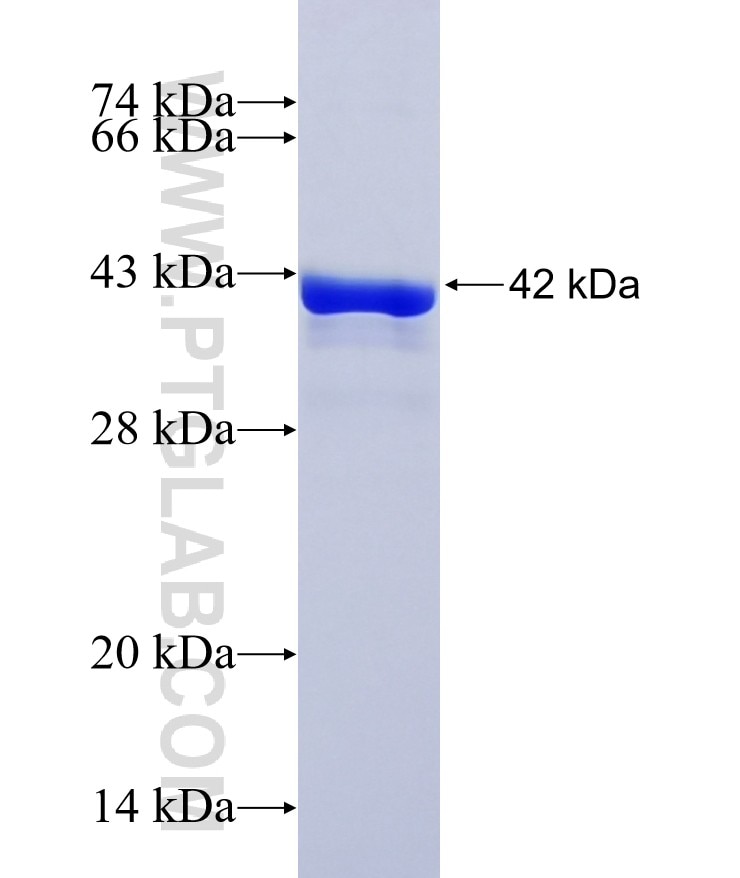 KIAA0895L fusion protein Ag37410 SDS-PAGE KIAA0895L fusion protein Ag37410 SDS-PAGE