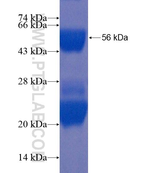 KIAA0907 fusion protein Ag22217 SDS-PAGE