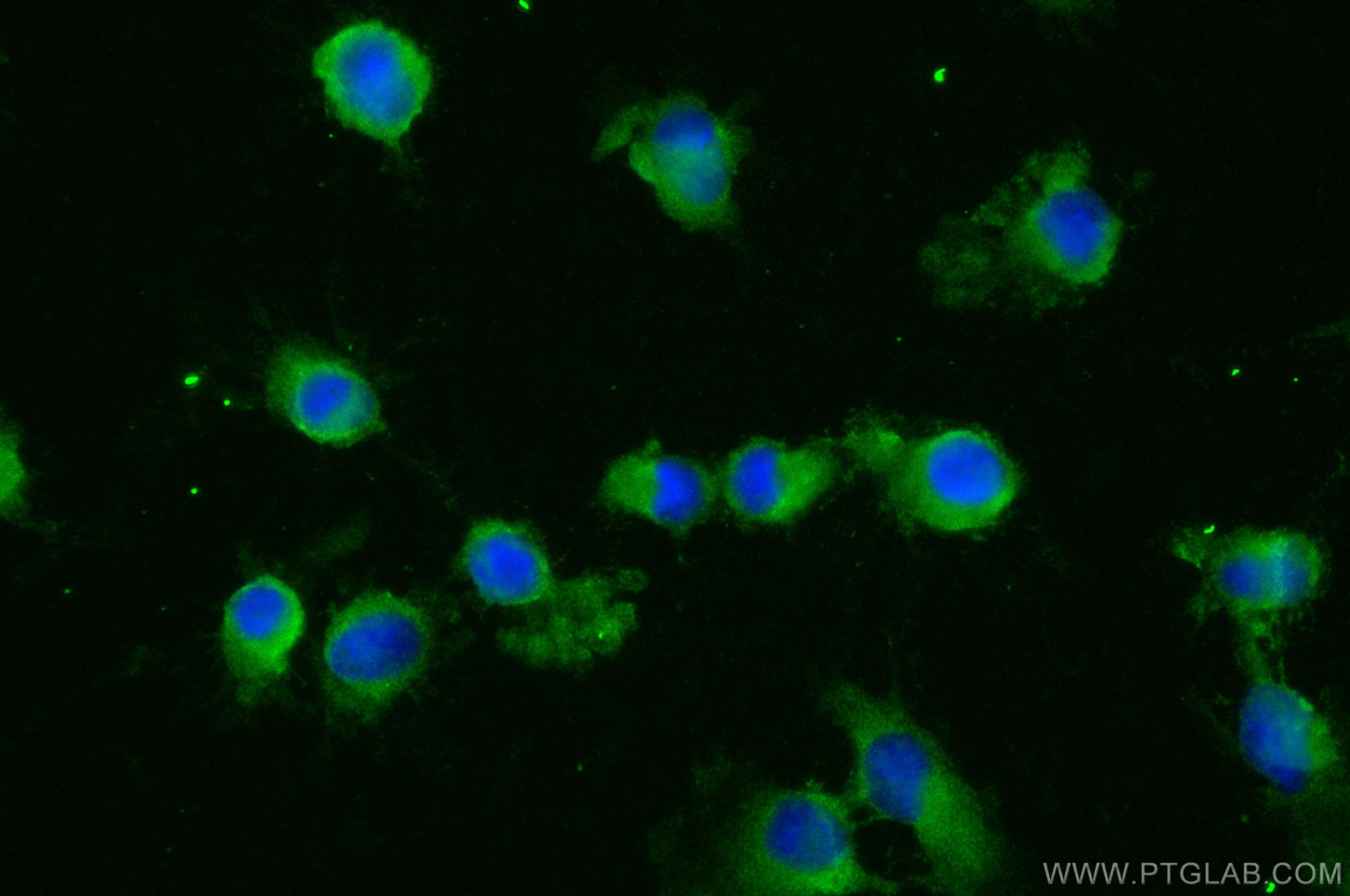 Immunofluorescence (IF) / fluorescent staining of U-251 cells using KIAA0922 Polyclonal antibody (23360-1-AP)