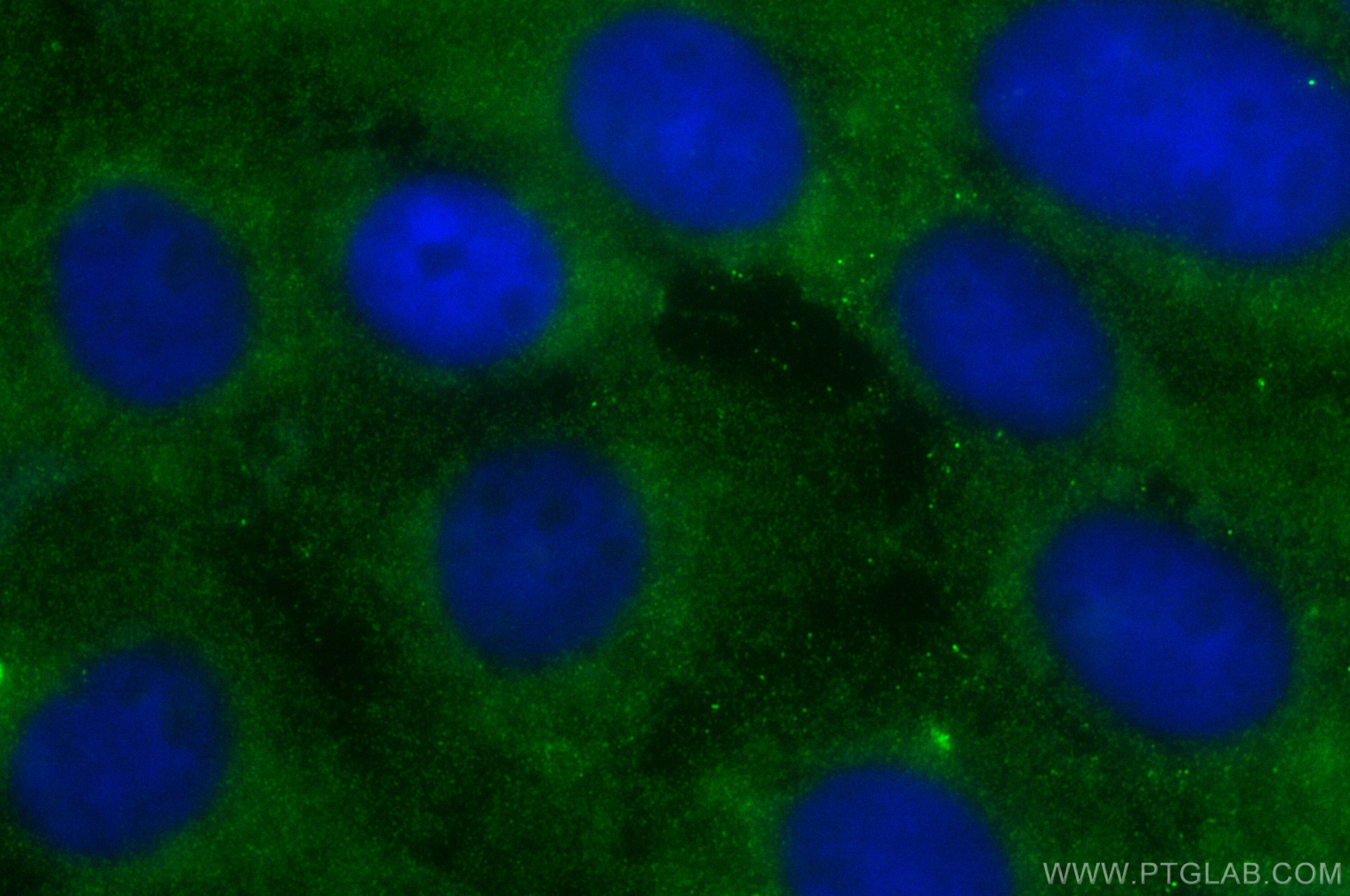 Immunofluorescence (IF) / fluorescent staining of A431 cells using KIAA0922 Polyclonal antibody (23360-1-AP)