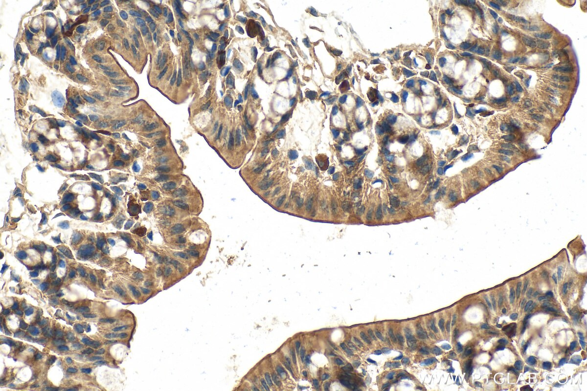 Immunohistochemistry (IHC) staining of mouse colon tissue using KIAA0922 Polyclonal antibody (23360-1-AP)