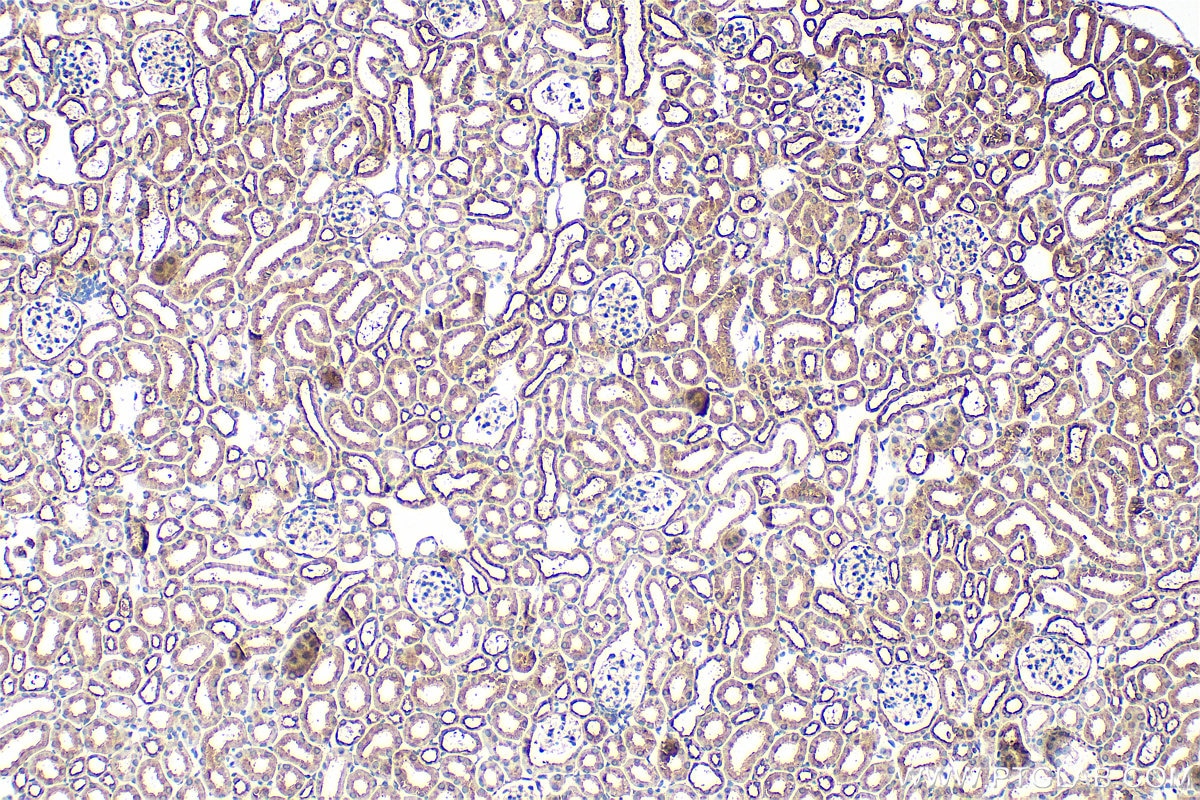 IHC staining of mouse kidney using 23360-1-AP Immunohistochemistry (IHC) staining of mouse kidney tissue using KIAA0922 Polyclonal antibody (23360-1-AP)