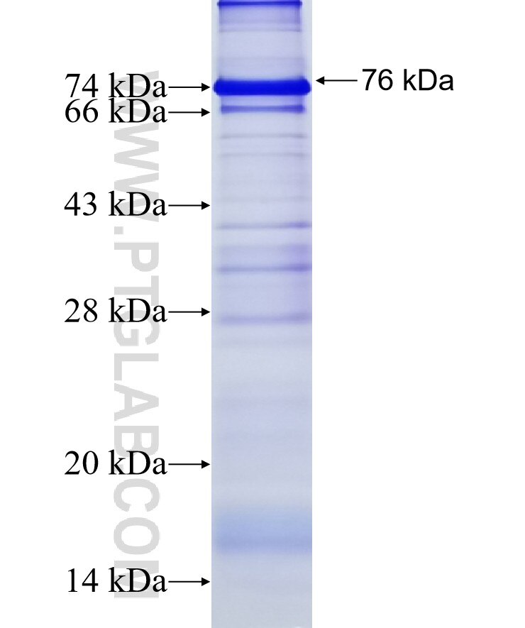 KIAA0922 fusion protein Ag19898 SDS-PAGE