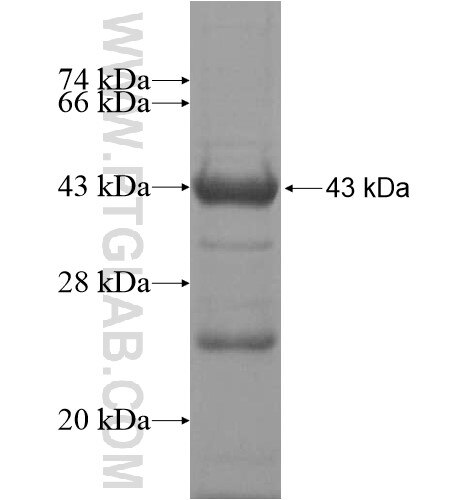 KIAA0947 fusion protein Ag13997 SDS-PAGE