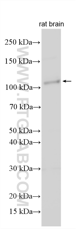 Western Blot (WB) analysis of various lysates using KIAA1024 Polyclonal antibody (32467-1-AP)