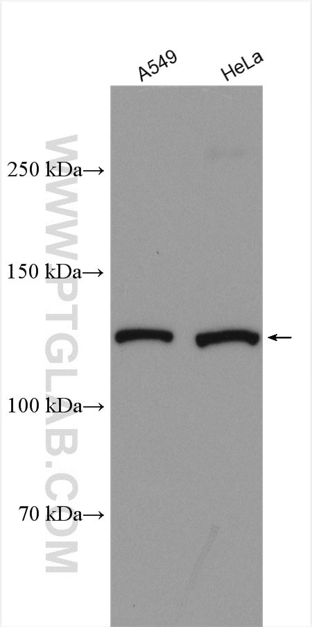 Western Blot (WB) analysis of various lysates using KIAA1033 Polyclonal antibody (51101-1-AP)