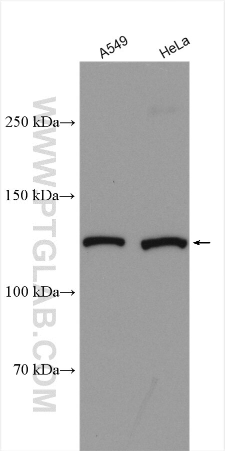 Western Blot (WB) analysis of various lysates using KIAA1033 Polyclonal antibody (51101-1-AP)