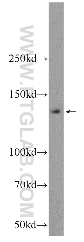 Western Blot (WB) analysis of HeLa cells using KIAA1033 Polyclonal antibody (51101-1-AP)