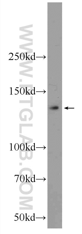 Western Blot (WB) analysis of HeLa cells using KIAA1033 Polyclonal antibody (51101-1-AP)