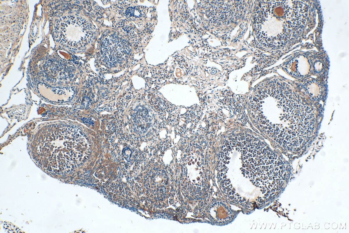 Immunohistochemistry (IHC) staining of mouse ovary tissue using KIAA1109 Polyclonal antibody (26349-1-AP)